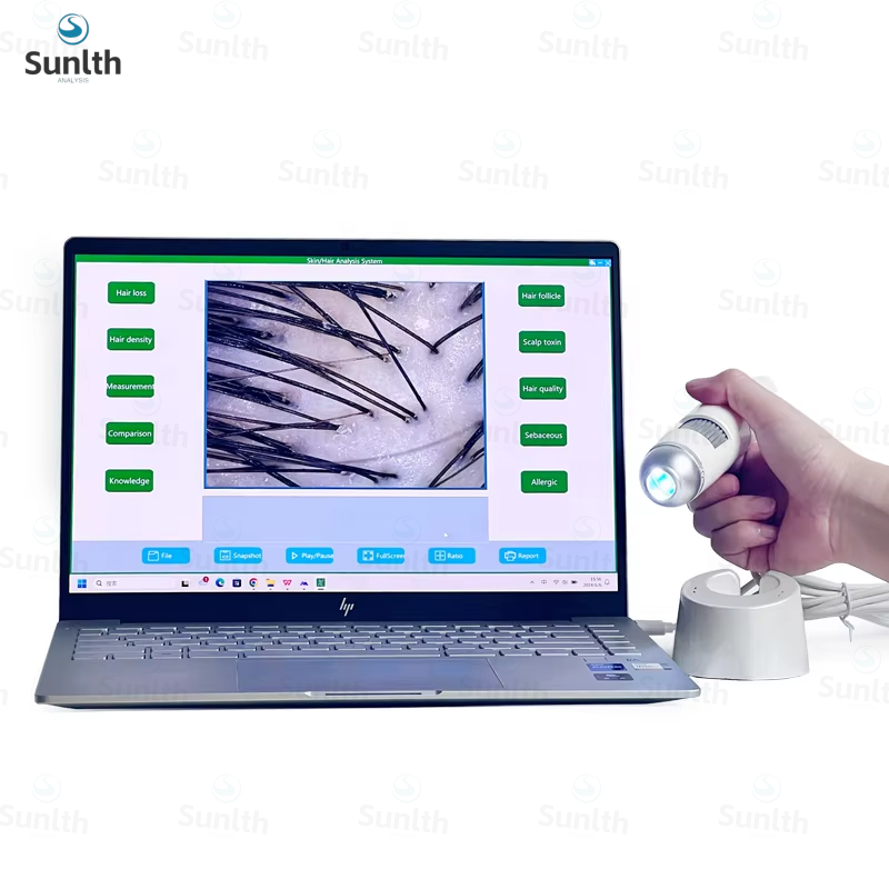 Système Windows avec rapport U - Hair Porosity Test avis et prix