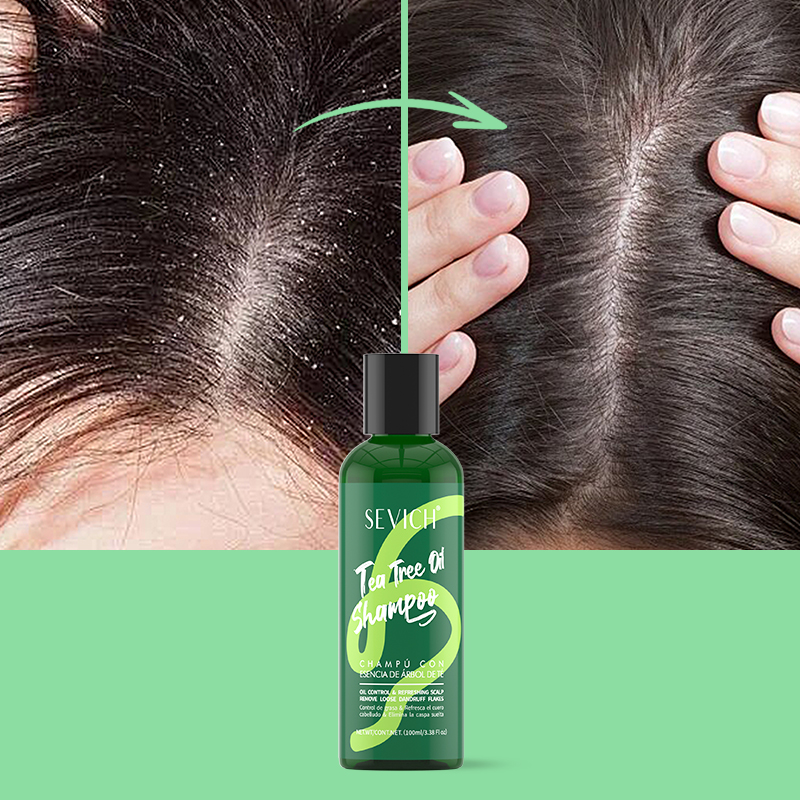 Shampoing à l'essence d'arbre  - Hair Care Conditioner avis et prix
