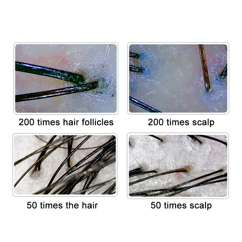Détecteur de cuir chevelu et d - Hair Porosity Test avis et prix