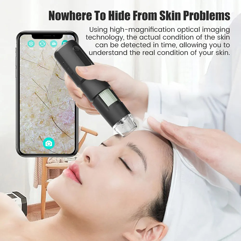 Dermatoscope sans fil analyseu - Hair Porosity Test avis et prix